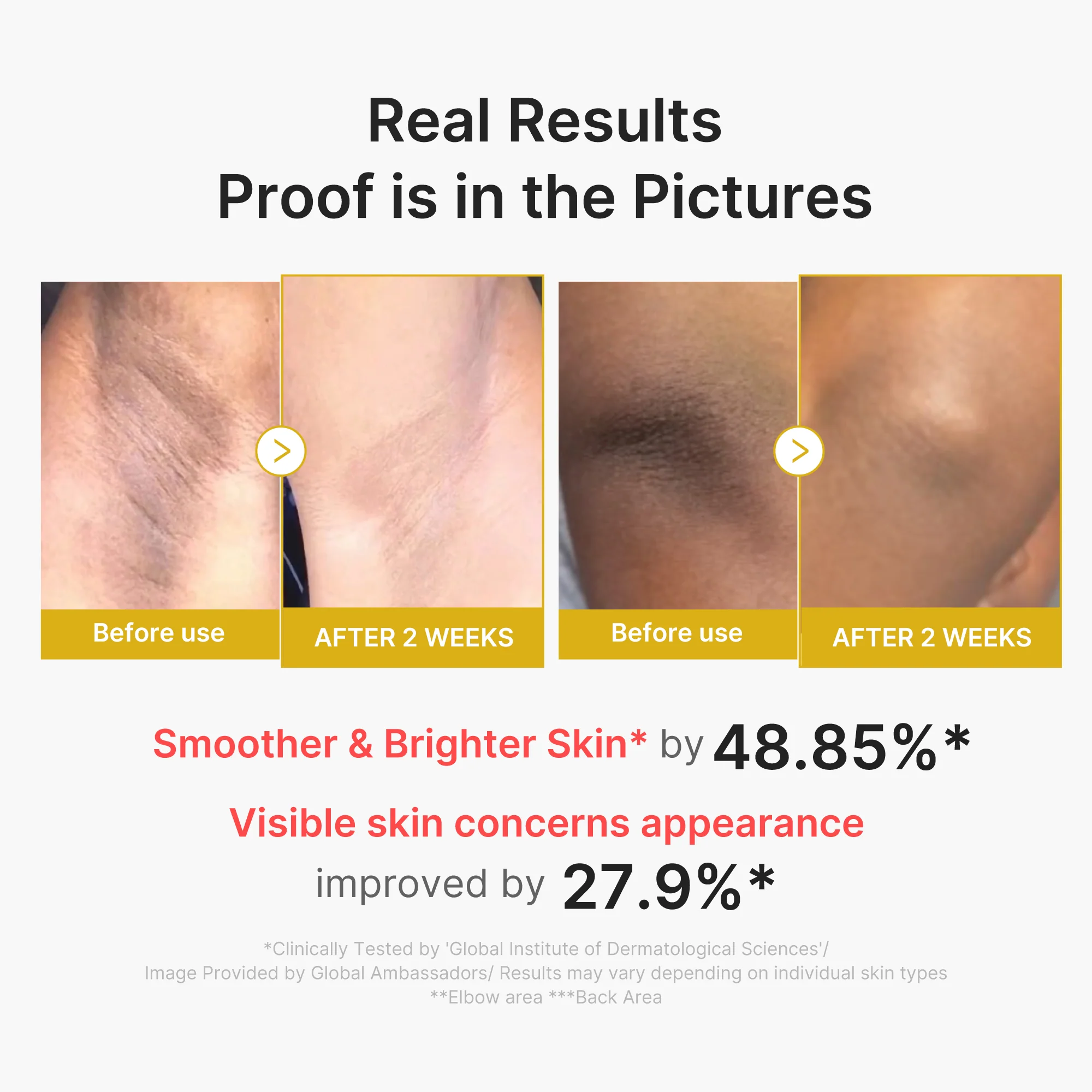 Kojic Acid Turmeric Body Peel Shot - Image 3