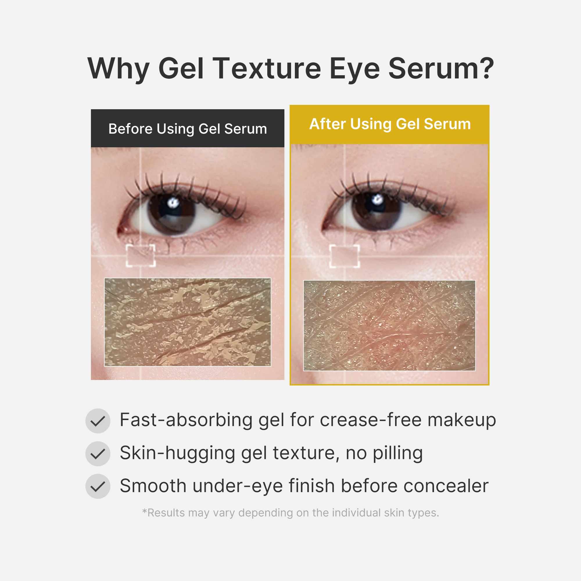 Kojic Acid Tumeric Eye Gel Concentrate - Image 6