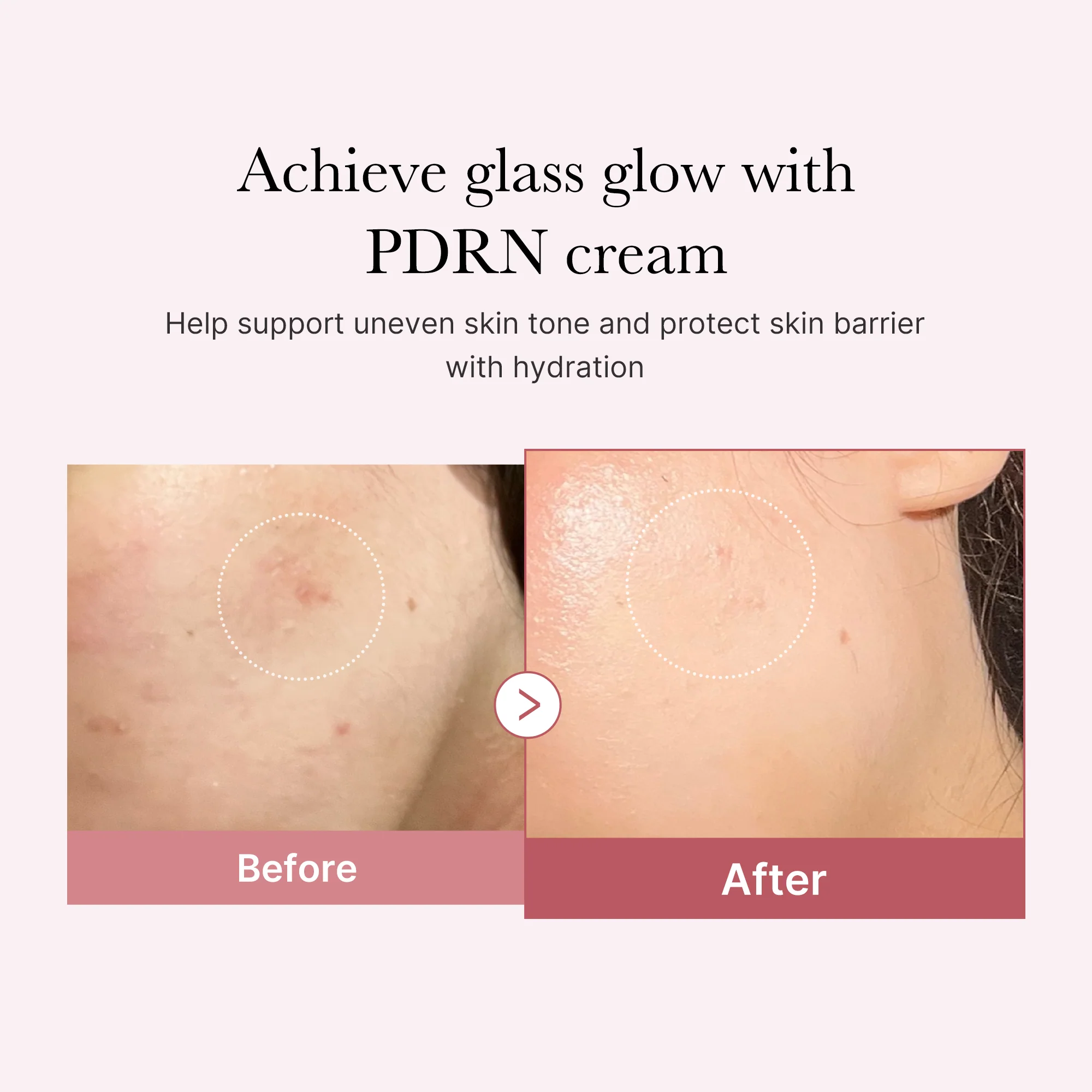 PDRN Pink Peptide Balm - Salmon DNA PDRN - Image 3