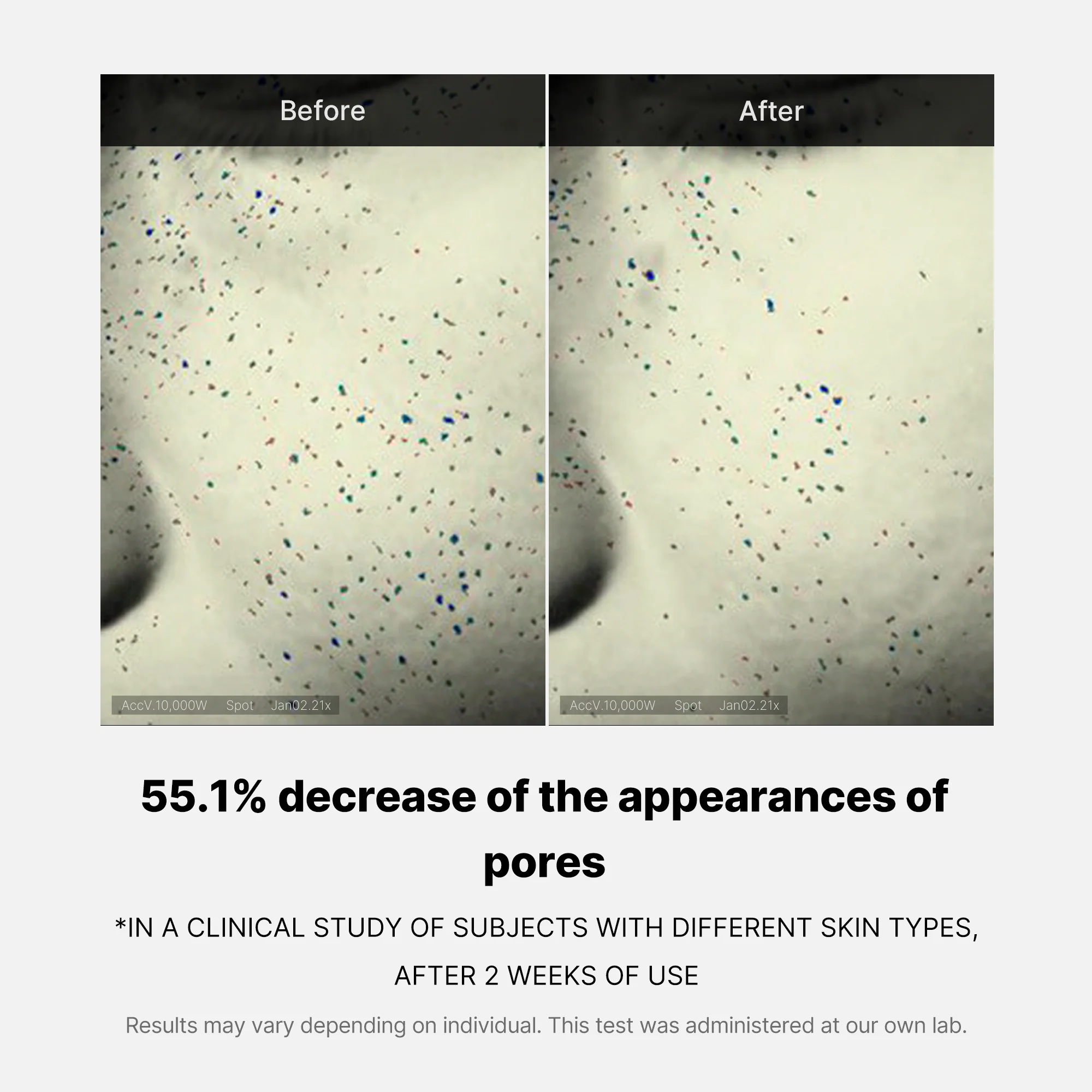 Pore Care Duo - Image 10