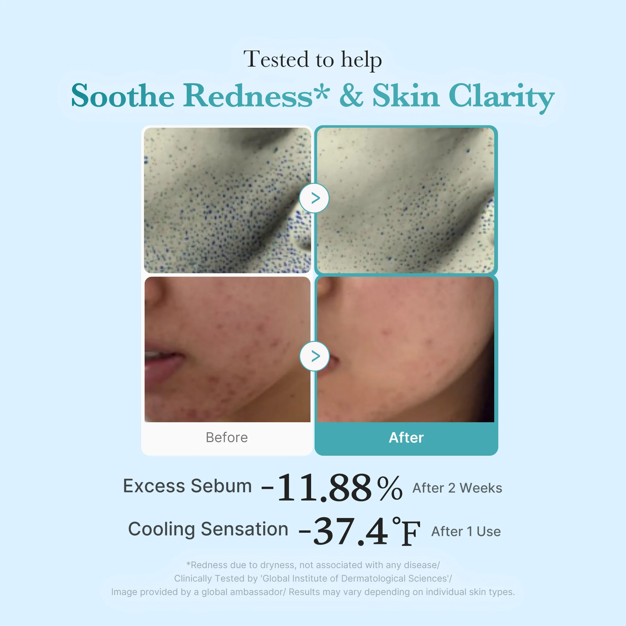 Azelaic Acid Niacinamide Clarifying Toner - Image 4