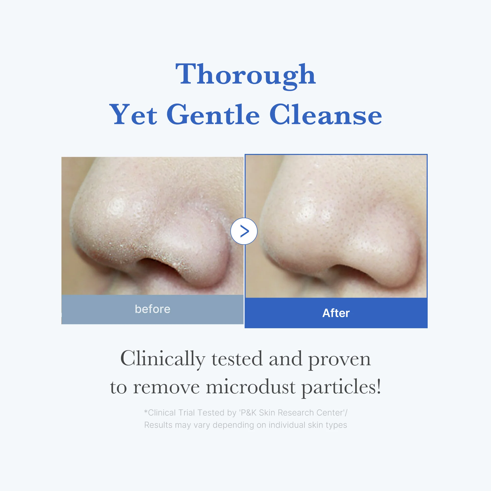 Zero Foam Cleanser - Image 3