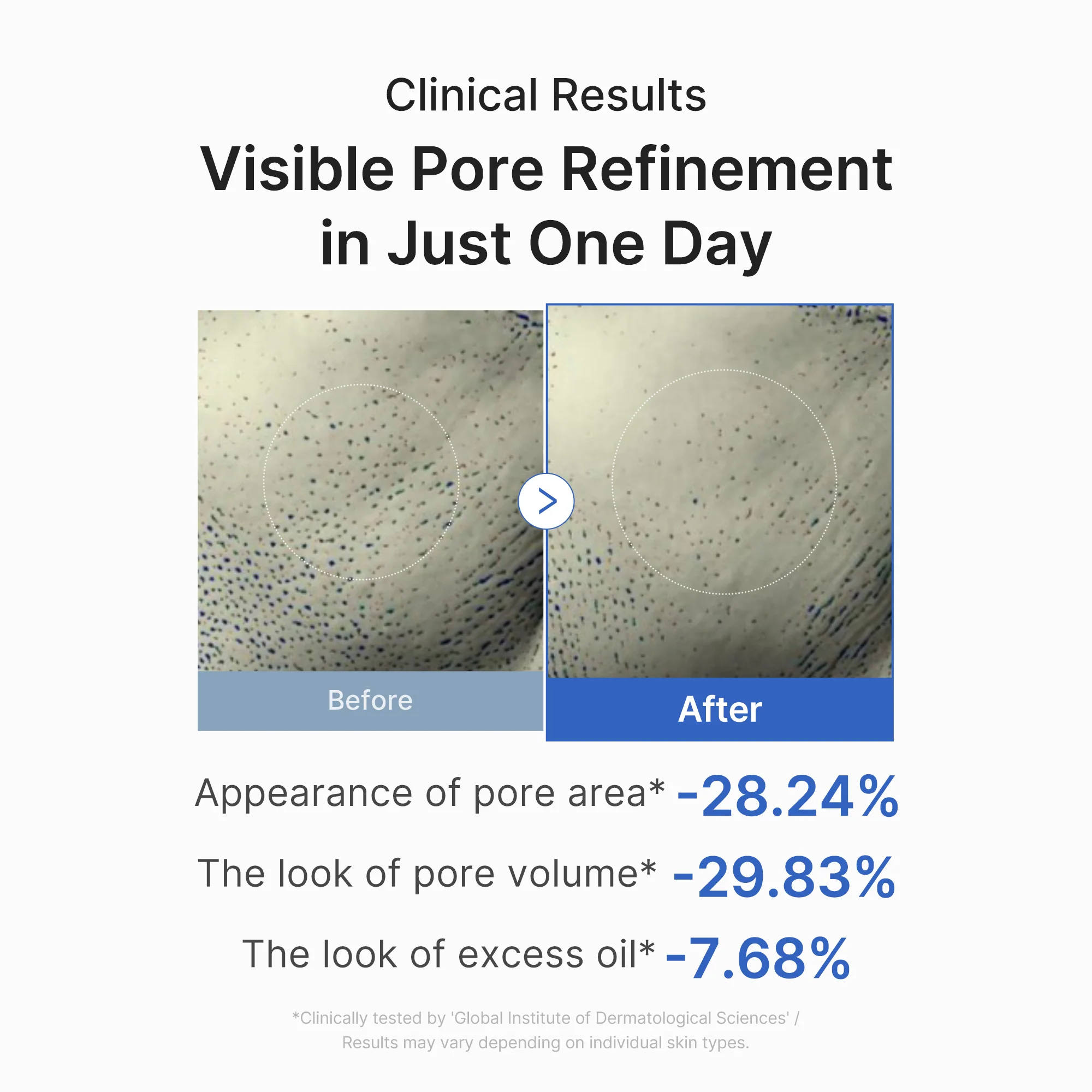 Pore Care Duo - Image 5