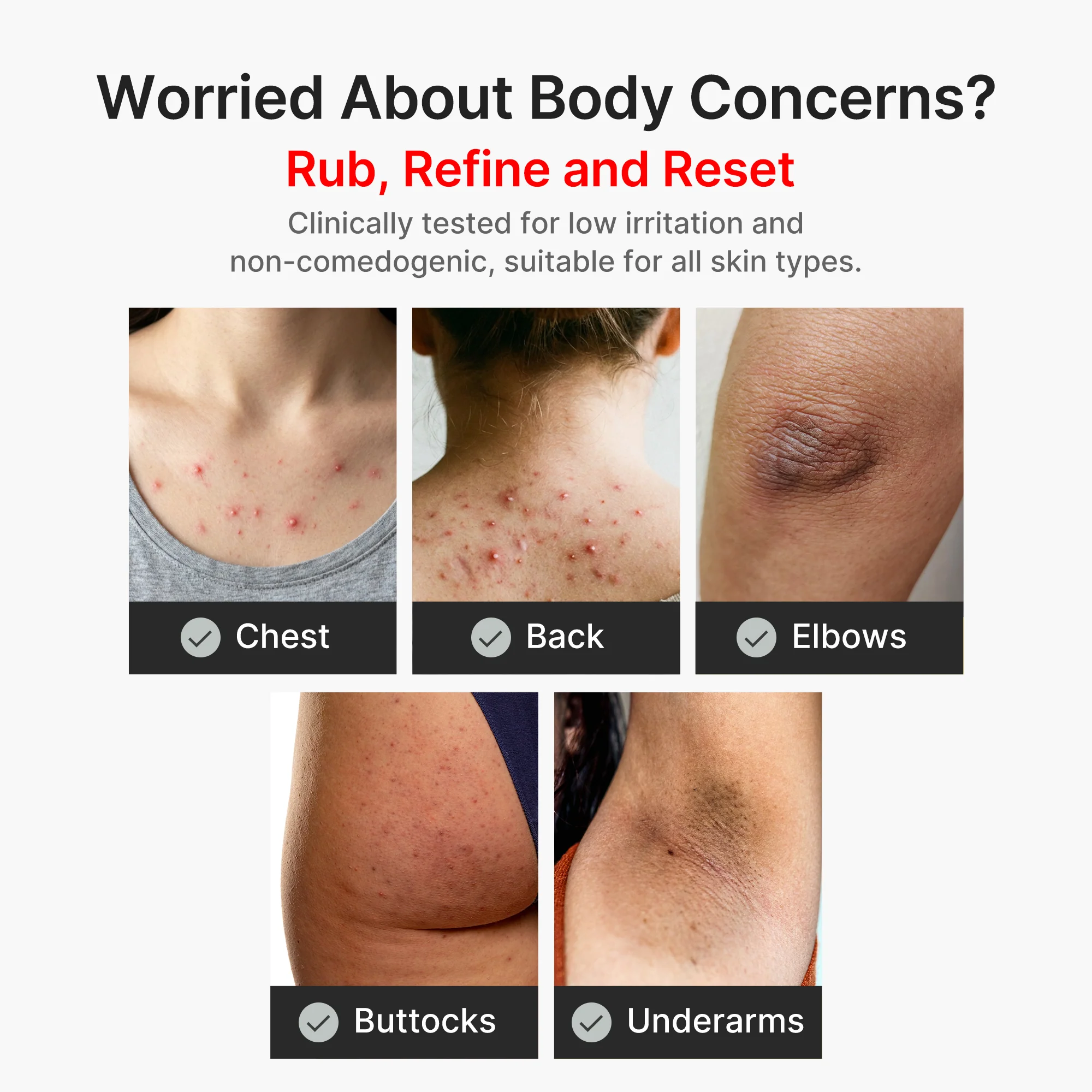 Kojic Acid Turmeric Body Peel Shot - Image 5