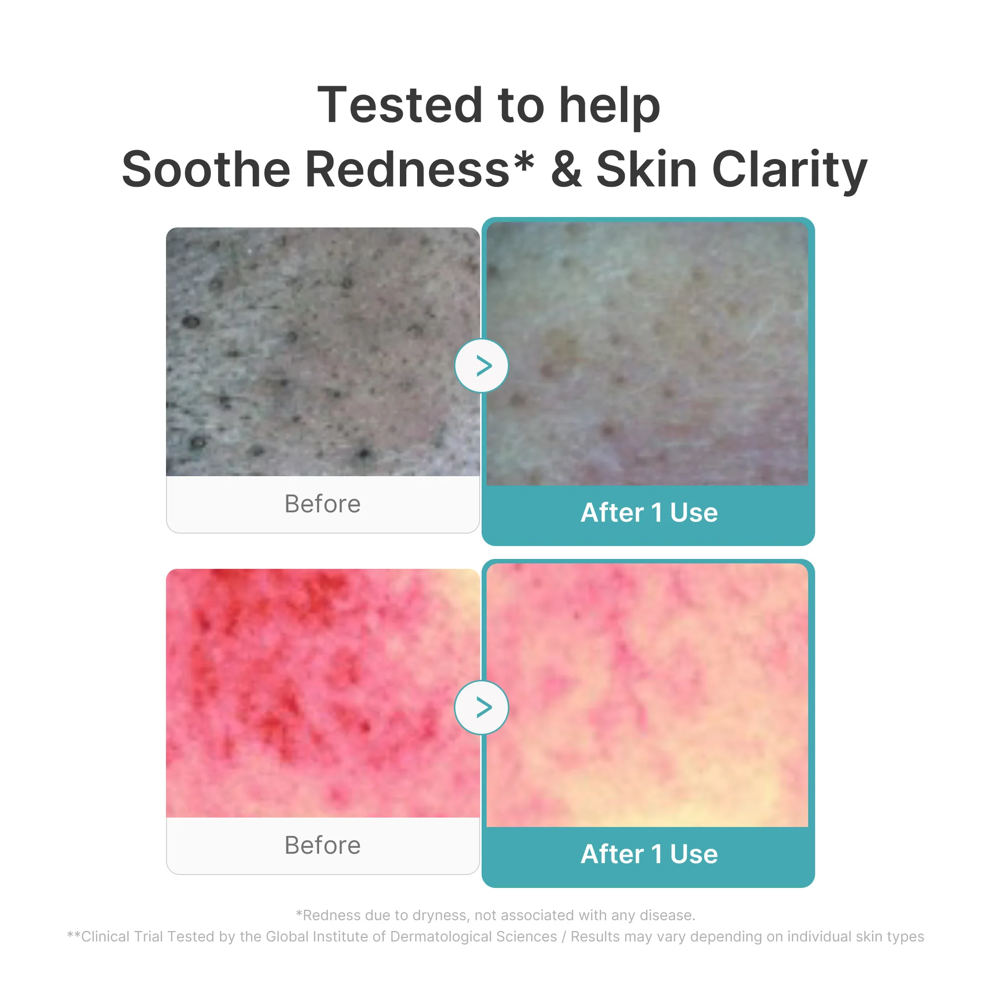 Azelaic Acid Capsule Foam Cleanser - Image 4