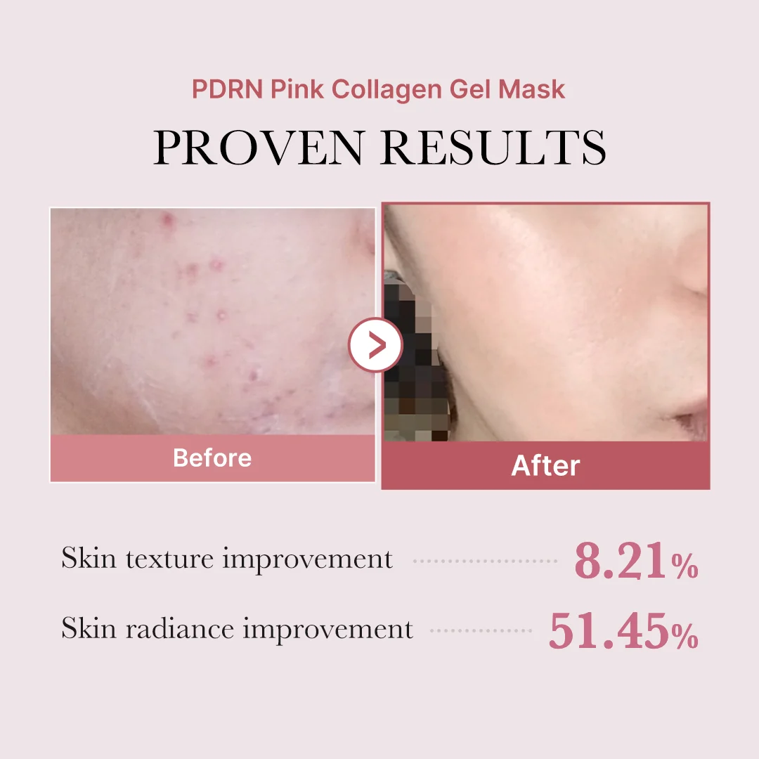 PDRN Pink Glow Full Set - Salmon DNA PDRN - Image 6