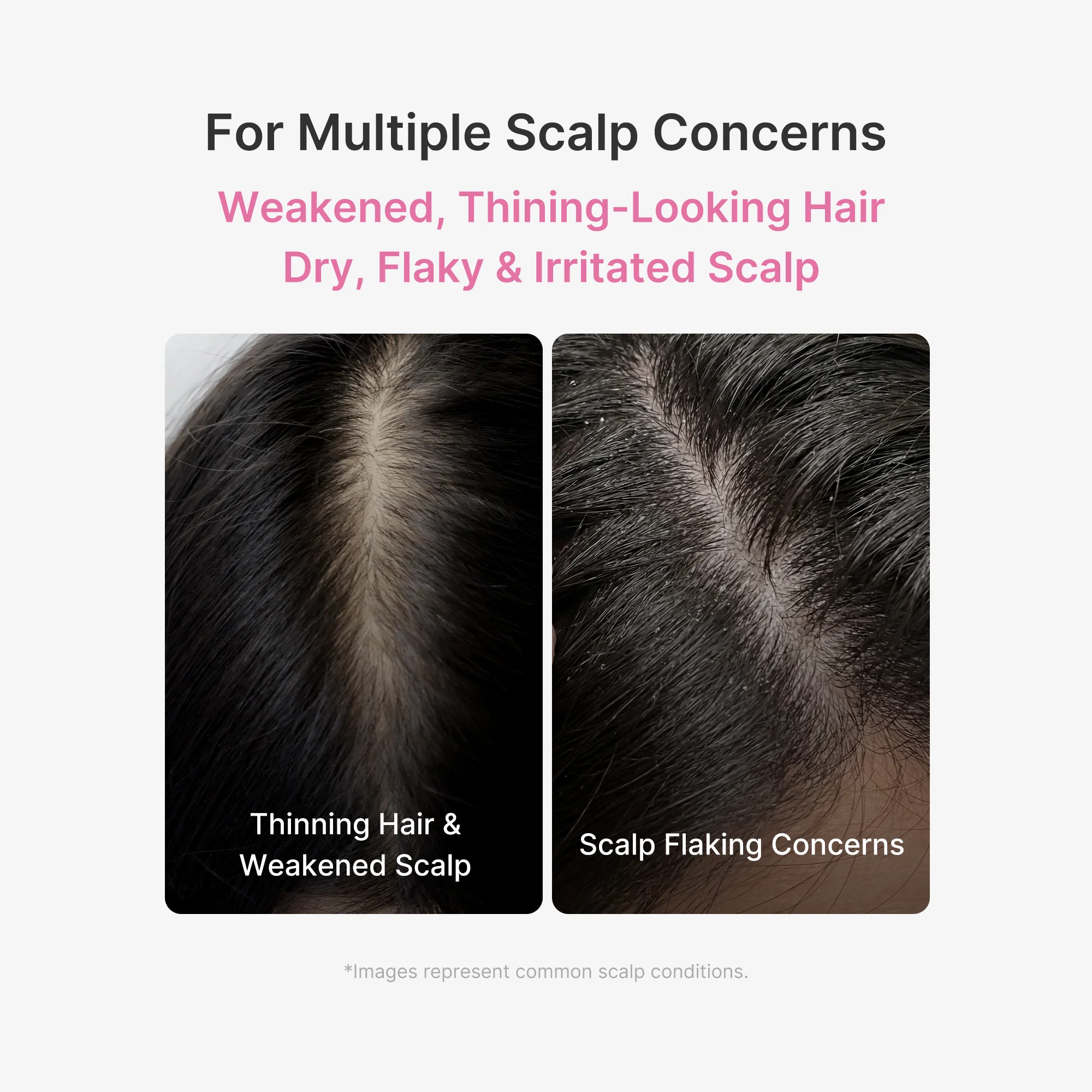 Rosemary PDRN Scalp Serum - Image 3