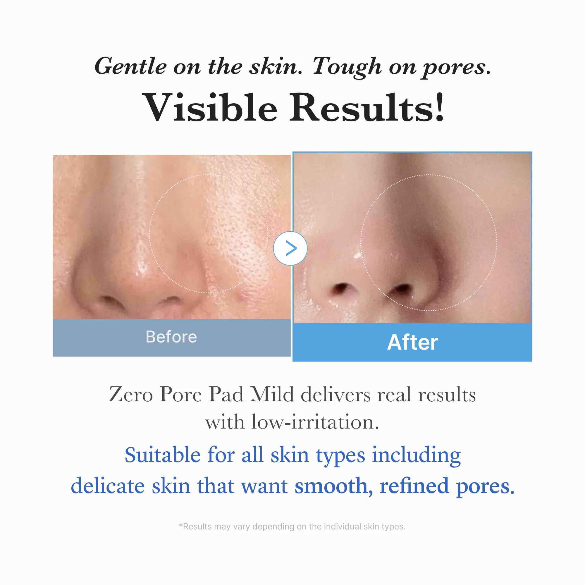 Zero Pore Madecassoside Pads (Mild) - SINGLE - Image 5